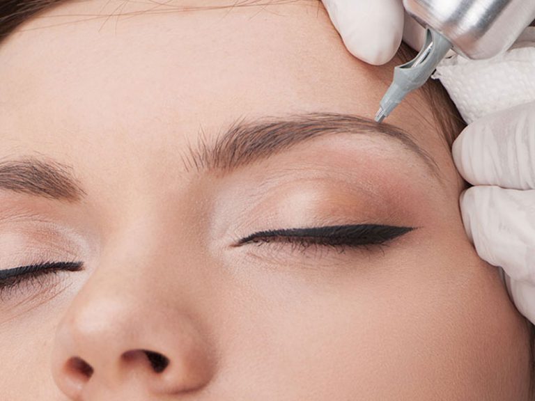 cryopigmentation