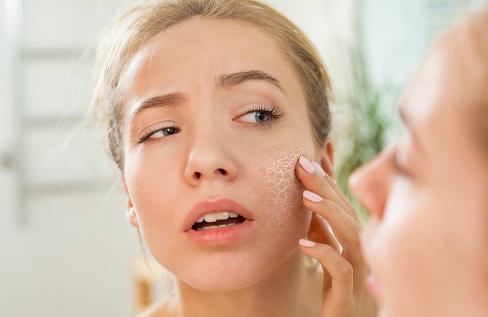 sucha skóra - poradnik