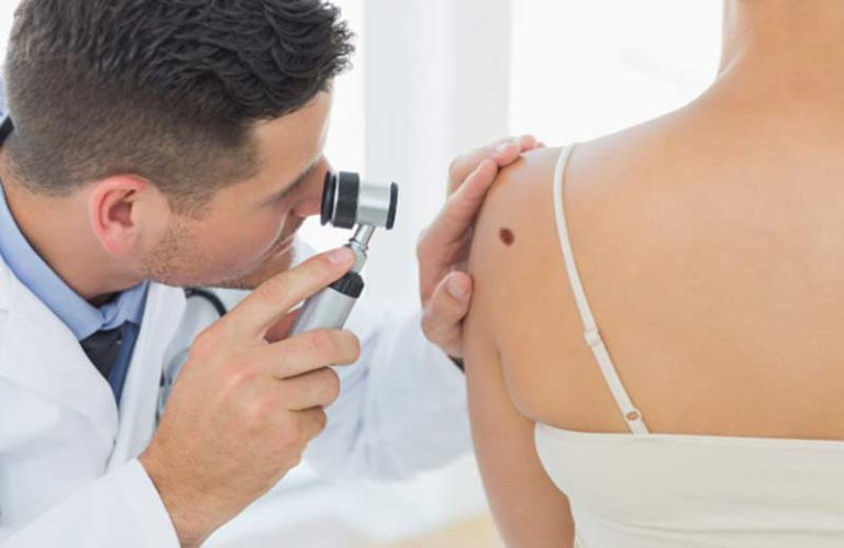Zmiany skórne – kiedy należy udać się do dermatologa?