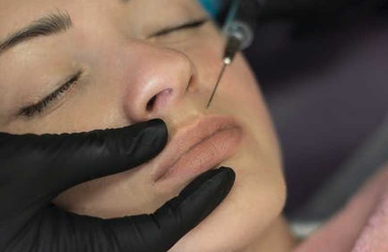 Botox najczęściej praktykowanym zabiegiem estetycznym twarzy na świecie