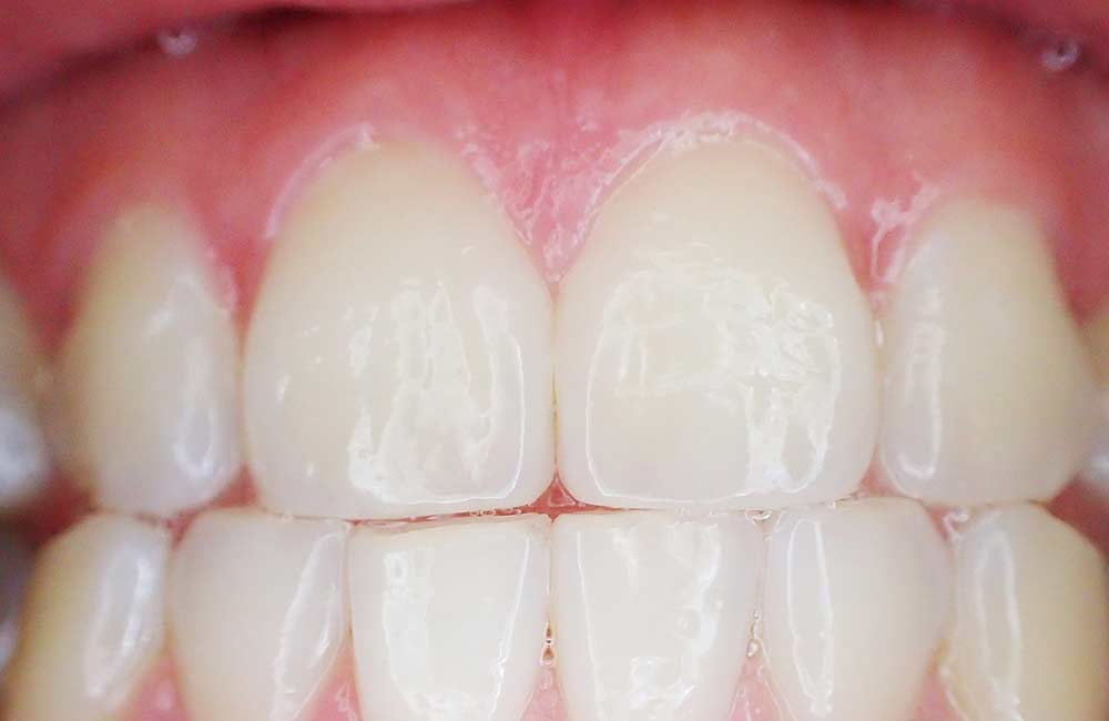 Paski wybielające Crest