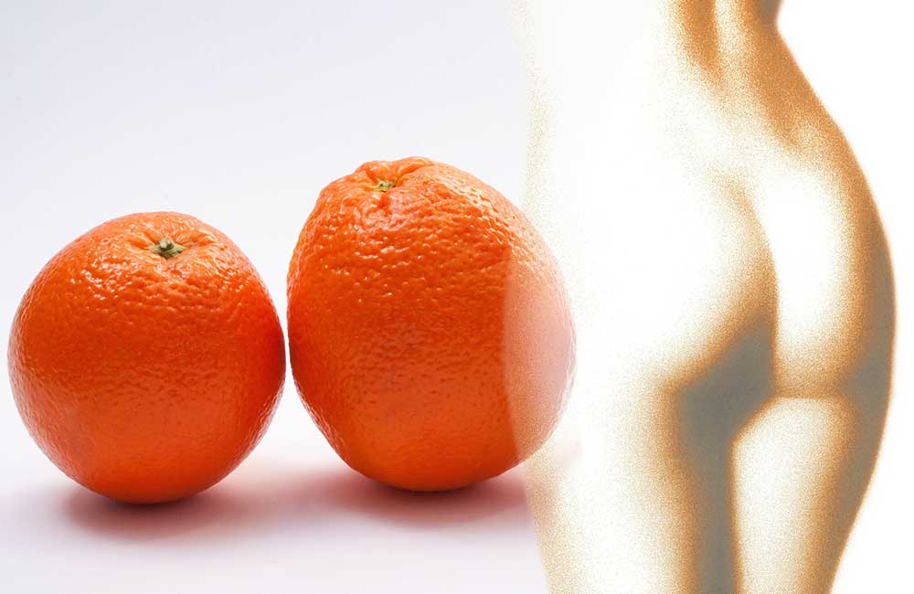 Nowoczesne metody - jak się pozbyć cellulitu?