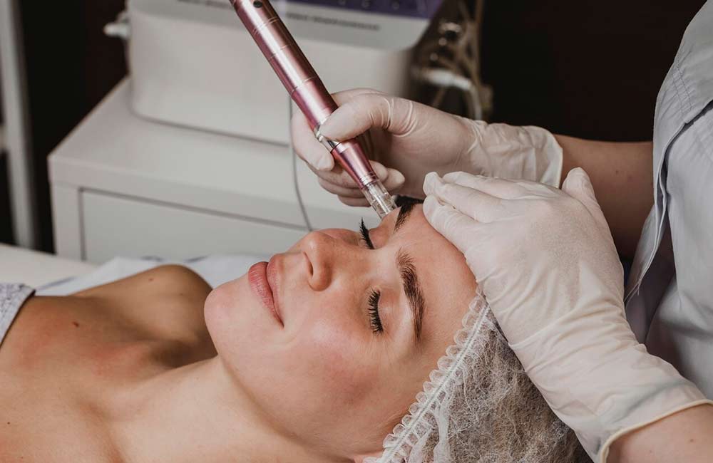 Mezoterapia Mikroigłowa z BioRePeel