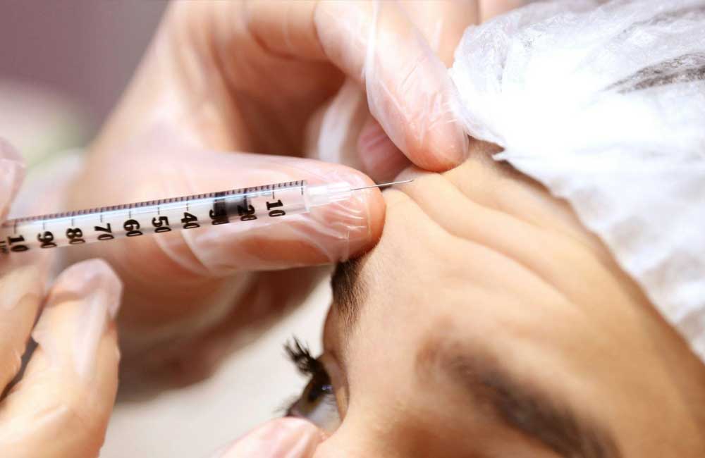 Znaczenie wypełniaczy w nowoczesnej medycynie estetycznej Znaczenie wypełniaczy w nowoczesnej medycynie estetycznej